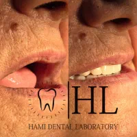 تکنسین و کارآموز دندانسازی