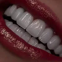 جشنواره تمام خدمات دندون پزشکی .وکامپوزیت