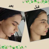 پاکسازی صورت حرفه ایی همراه با ماساژ500