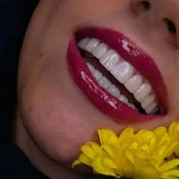 کامپوزیت دندان ۲۰درصد تخفیف تا آخر هفته