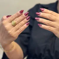 کاشت وترمیم ناخن تخصصی با تخفیف ویژه
