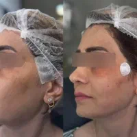 مدرن ترین جراحی های زیبایی و تزریقی...
