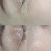 خدمات تخصصی فیشیال با۲۵٪ تخفیف ویژه