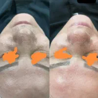 فرصت محدود دوهفته تخفیفات فیشال
