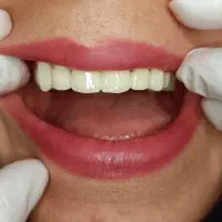 خدمات دندان پزشکی لبخند سفید