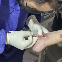 پرستار،انواع زخم و پانسمان