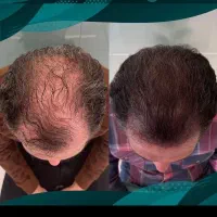 اعتماد به نفس میخوای