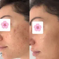 بیوممتیک فرانسه اصل ضد پیری