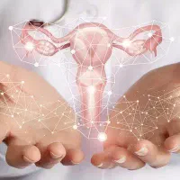 حذف تنبلی تخمدان