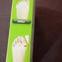 فاصله دهنده انگشتان پا