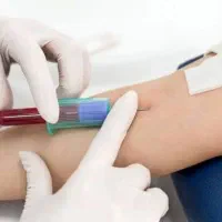 تزریقات،حجامت،خالبرداری درمحل شما