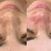 آموزش وخدمات فیشیال تخصصی ،ماساژ، پدیکور بانوان