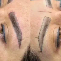 تتو و میکروبیلدینگ فیبروز