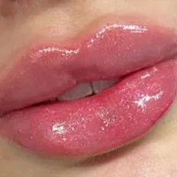 جشنواره عیدانه ژل،بوتاکس،مزوژل