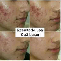 کلینیک زیبایی پوست و مو و لیزر شاتی آپادانا