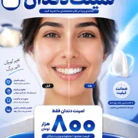 Fz بال تونFJzf