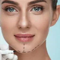 اعمال زیبایی وتزریق ژل ،بوتاکس با تخفیف توسط پزشک