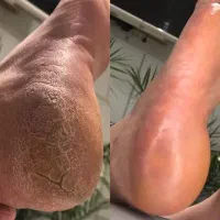 تخفیف کف سابی پا