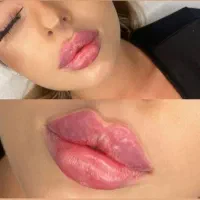 استخدام لیدروادمین بامشتری مطب پزشک۳۰الی۴۰درصد
