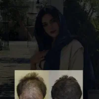 پسر بدون ریش کنسله