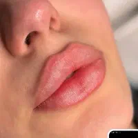 مدل فیلر