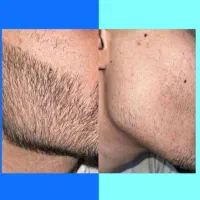 بمب جذابیت