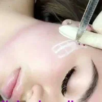 افر استثنایی فیلر بادی،بوتاکس،کانتورینگ،ژل مزوژل|خدمات آرایشگری و زیبایی|تهران, تهرانسر مرکزی|دیوار