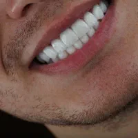زیبایی ودندان