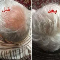 تونیک ضد ریزش و تقویت مو و ابرو لدورا قیمت قدیم
