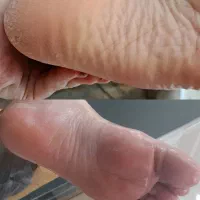 اسپا تخصصی و ژلیش رایگان