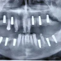 کلینیک دندانپزشکی،کرمانشاه، کلیه خدمات دندان