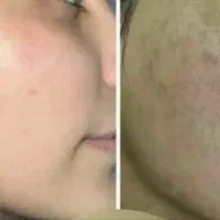 صورتی بی نقص رو تجربه کن
