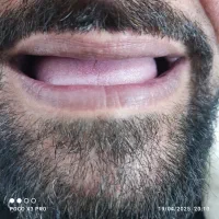 ساخت تخصصی دندان مصنوعی(دندانسازی) (از دم قسط)