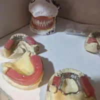 سافت لاینر آستری پروتز دنچر  رفع لقی تعمیر شکستگی