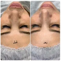مدل خانم برای فشیال پوست فقط نصف هزینه مواد (۶۵۰)