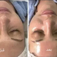 برای اولین بار فیشیال تخصصی در شهرک طالقانی