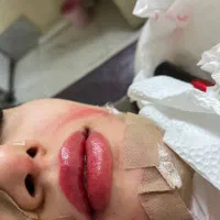 آموزش تینت لب و شیدینگ