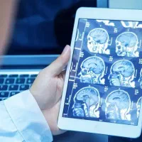 پرینت تصاویر پزشکی انجام  رادیو لوژی  mri