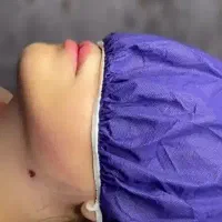 ساکشن و تخلیه و تزریق