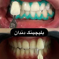 *فقط یک جلسه تا لبخندی چند درجه روشن تر