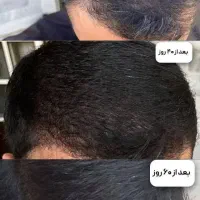 معجزه روغنهای خوراکی وموضعی