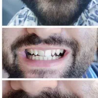 مسواک خمیردندان سفیدکننده و اسپری رفع بوی سیگار