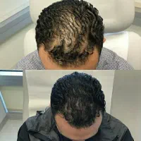 از آینه دوباره لذت ببر