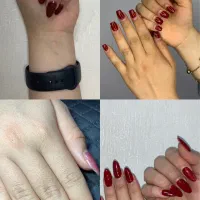 کاشت و ترمیم ناخون