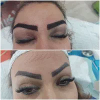 کلینیک مجوزدار کاشت ابرو در قم