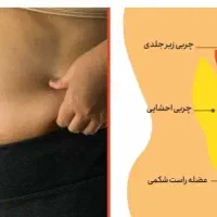 کاهش درمان لاغری
