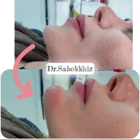 انجام خدمات زیبایی توسط پزشک