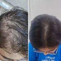 خط رویشت رفته عقب