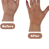 مدل جهت فیلر