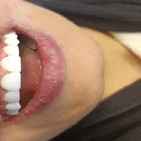دستیار دندانپزشکی